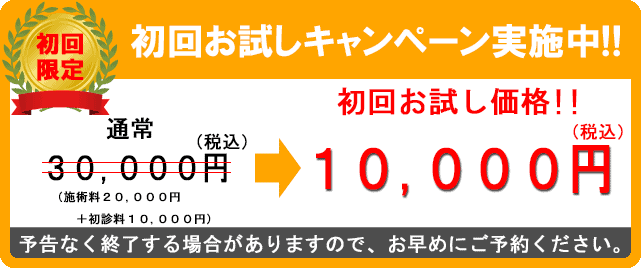 初回割引バナー 30000円